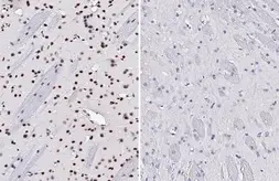 Anti-p38 MAPK (phospho Thr180 / Tyr182) antibody [HL2741] used in IHC (Paraffin sections) (IHC-P). GTX639570