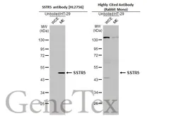 Anti-SSTR5 antibody [HL2756] used in Western Blot (WB). GTX639619
