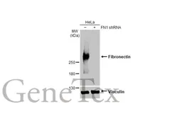Anti-Fibronectin antibody [HL2761] used in Western Blot (WB). GTX639626