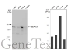 Anti-CEP152 antibody [HL2763] used in Western Blot (WB). GTX639628