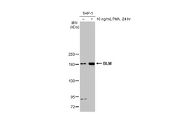 Anti-BLM antibody [HL2771] used in Western Blot (WB). GTX639636