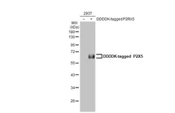 Anti-P2X5 antibody [HL2773] used in Western Blot (WB). GTX639638