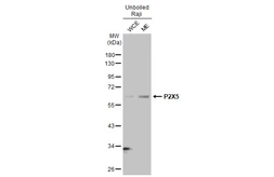 Anti-P2X5 antibody [HL2773] used in Western Blot (WB). GTX639638