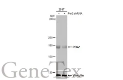 Anti-PER2 antibody [HL2775] used in Western Blot (WB). GTX639640