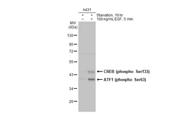Anti-CREB (phospho Ser133) antibody [HL2776] used in Western Blot (WB). GTX639641