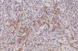 Anti-CCR5 antibody [HL2780] used in IHC (Paraffin sections) (IHC-P). GTX639645