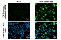 Anti-FSH Receptor antibody [HL2784] used in Immunocytochemistry/ Immunofluorescence (ICC/IF). GTX639652