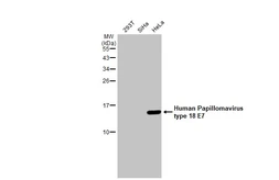 Anti-Human Papillomavirus type 18 E7 antibody [HL2787] used in Western Blot (WB). GTX639655