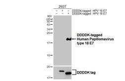 Anti-Human Papillomavirus type 18 E7 antibody [HL2787] used in Western Blot (WB). GTX639655