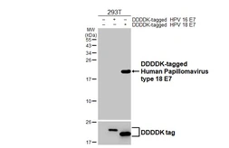 Anti-Human Papillomavirus type 18 E7 antibody [HL2788] used in Western Blot (WB). GTX639656