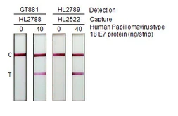 Anti-Human Papillomavirus type 18 E7 antibody [HL2789] used in Lateral Flow (Lateral Flow). GTX639657