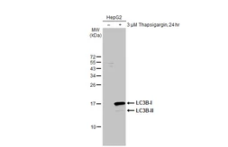 Anti-LC3B antibody [HL2798] used in Western Blot (WB). GTX639686