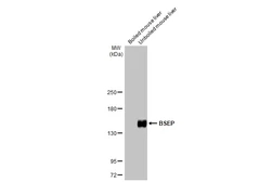 Anti-BSEP antibody [HL2803] used in Western Blot (WB). GTX639695