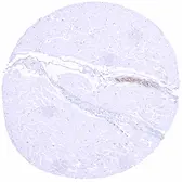 Anti-Tyrosine Hydroxylase antibody [HMV312] HistoMAX&trade; used in IHC (Paraffin sections) (IHC-P). GTX639936