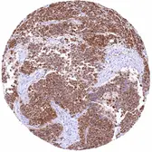 Anti-TRIM72 antibody [HMV313] HistoMAX&trade; used in IHC (Paraffin sections) (IHC-P). GTX639937