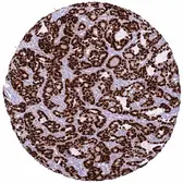 Anti-HMGA2 antibody [HMV314] HistoMAX&trade; used in IHC (Paraffin sections) (IHC-P). GTX639938