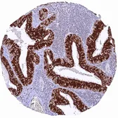 Anti-SDHB antibody [HMV320] HistoMAX&trade; used in IHC (Paraffin sections) (IHC-P). GTX639944