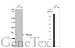 Anti-PCSK9 antibody [HL2814] used in Western Blot (WB). GTX639955