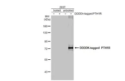 Anti-PTH1R antibody [HL2817] used in Western Blot (WB). GTX639958