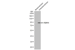 Anti-P2Y11 antibody [HL2821] used in Western Blot (WB). GTX640092