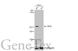 Anti-TET2 antibody [HL2822] used in Western Blot (WB). GTX640093