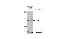 Anti-CCR1 antibody [HL2840] used in Western Blot (WB). GTX640111