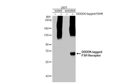 Anti-FSH Receptor antibody [HL2841] used in Western Blot (WB). GTX640112