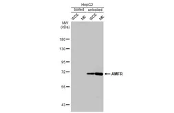 Anti-AMFR antibody [HL2865] used in Western Blot (WB). GTX640142
