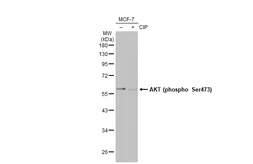 Anti-AKT (phospho Ser473) antibody [HL2871] used in Western Blot (WB). GTX640148