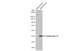Anti-Cytokeratin 19 antibody [HL2878] used in Western Blot (WB). GTX640155
