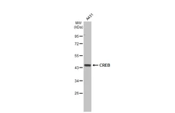 Anti-CREB antibody [HL2880] used in Western Blot (WB). GTX640159