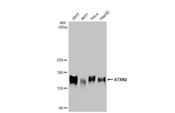 Anti-ATXN2 antibody [HL2885] used in Western Blot (WB). GTX640164