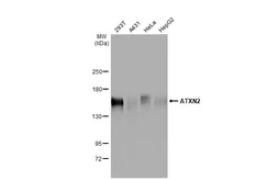 Anti-ATXN2 antibody [HL2886] used in Western Blot (WB). GTX640165