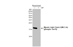 Anti-Myosin Light Chain 2 (MLC-2v) (phospho Ser15) antibody [HL2891] used in Western Blot (WB). GTX640170