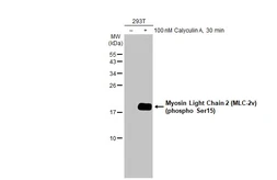 Anti-Myosin Light Chain 2 (MLC-2v) (phospho Ser15) antibody [HL2891] used in Western Blot (WB). GTX640170