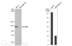 Anti-XPC antibody [HL2894] used in Western Blot (WB). GTX640231