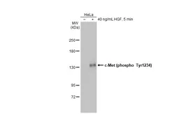 Anti-c-Met (phospho Tyr1234) antibody [HL2907] used in Western Blot (WB). GTX640244