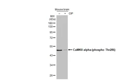 Anti-CaMKII alpha (phospho Thr286) antibody [HL2908] used in Western Blot (WB). GTX640251