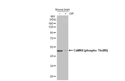 Anti-CaMKII alpha (phospho Thr286) antibody [HL2908] used in Western Blot (WB). GTX640251