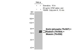 Anti-Ezrin (phospho Thr567) + Radixin (Thr564) + Moesin (Thr558) Antibody [HL2909] used in Western Blot (WB). GTX640252