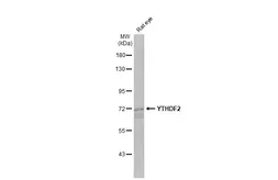 Anti-YTHDF2 antibody [HL2910] used in Western Blot (WB). GTX640253