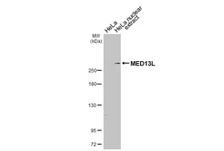 Anti-MED13L antibody [HL2911] used in Western Blot (WB). GTX640254
