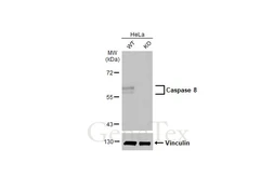 Anti-Caspase 8 antibody [HL2914] used in Western Blot (WB). GTX640257
