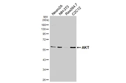 Anti-AKT antibody [HL2915] used in Western Blot (WB). GTX640258