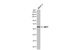 Anti-AKT antibody [HL2915] used in Western Blot (WB). GTX640258