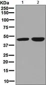 Anti-CABP1 antibody [EPR7916] used in Western Blot (WB). GTX64031