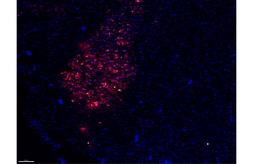 Anti-Powassan virus Envelope antibody [HL2955] used in IHC (Frozen sections) (IHC-Fr). GTX640340