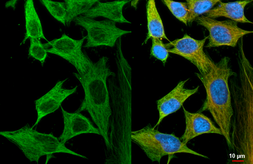 Anti-Flightless I antibody [HL2965] used in Immunocytochemistry/ Immunofluorescence (ICC/IF). GTX640352