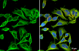 Anti-Flightless I antibody [HL2966] used in Immunocytochemistry/ Immunofluorescence (ICC/IF). GTX640353