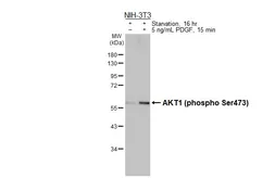 Anti-AKT1 (phospho Ser473) antibody [HL2972] used in Western Blot (WB). GTX640359